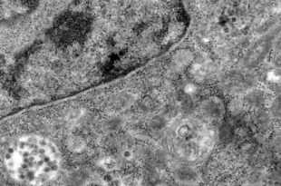 पहली-बार-वायरस-के-स्वस्थ-कोशिकाओं-को-संक्रमित-करने-की-तस्वीरें-आईं,-माइक्रोस्कोप-से-20-लाख-गुना-बड़ी-फोटो-दिखी